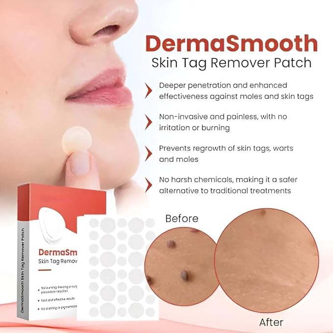 DermaSmooth Skin Tag Remover Patch |Fast, Easy & Effective for All Skin Types