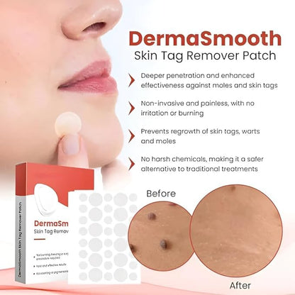 DermaSmooth Skin Tag Remover Patch |Fast, Easy & Effective for All Skin Types